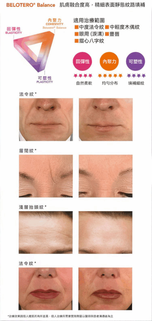 水無痕玻尿酸 CPM 專利技術：完美貼合肌膚 避免毛毛蟲凸起