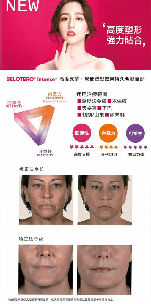 水無痕玻尿酸 內聚性與彈性圖解：高度支撐 精緻塑形