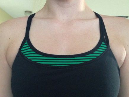 【副乳抽脂】- 消除內衣溢出的肥肉