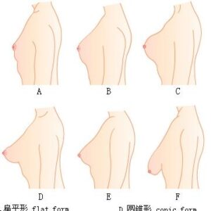 隆乳前要先瞭解，隆乳手術後何種胸型最受歡迎？