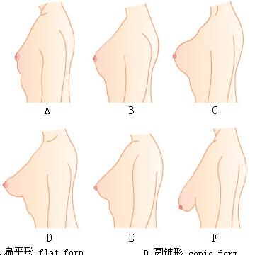 隆乳手術前對自我胸形瞭解非常重要