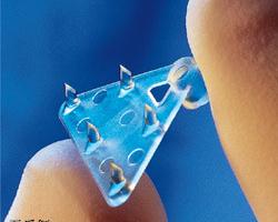 最eye媽咪 ~ 該要先割雙眼皮還是要先拉皮? – 談拉皮手術