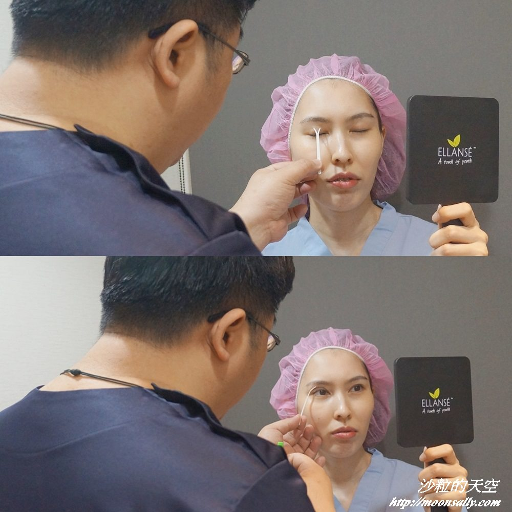 林敬鈞醫師手術模擬與諮詢現場2