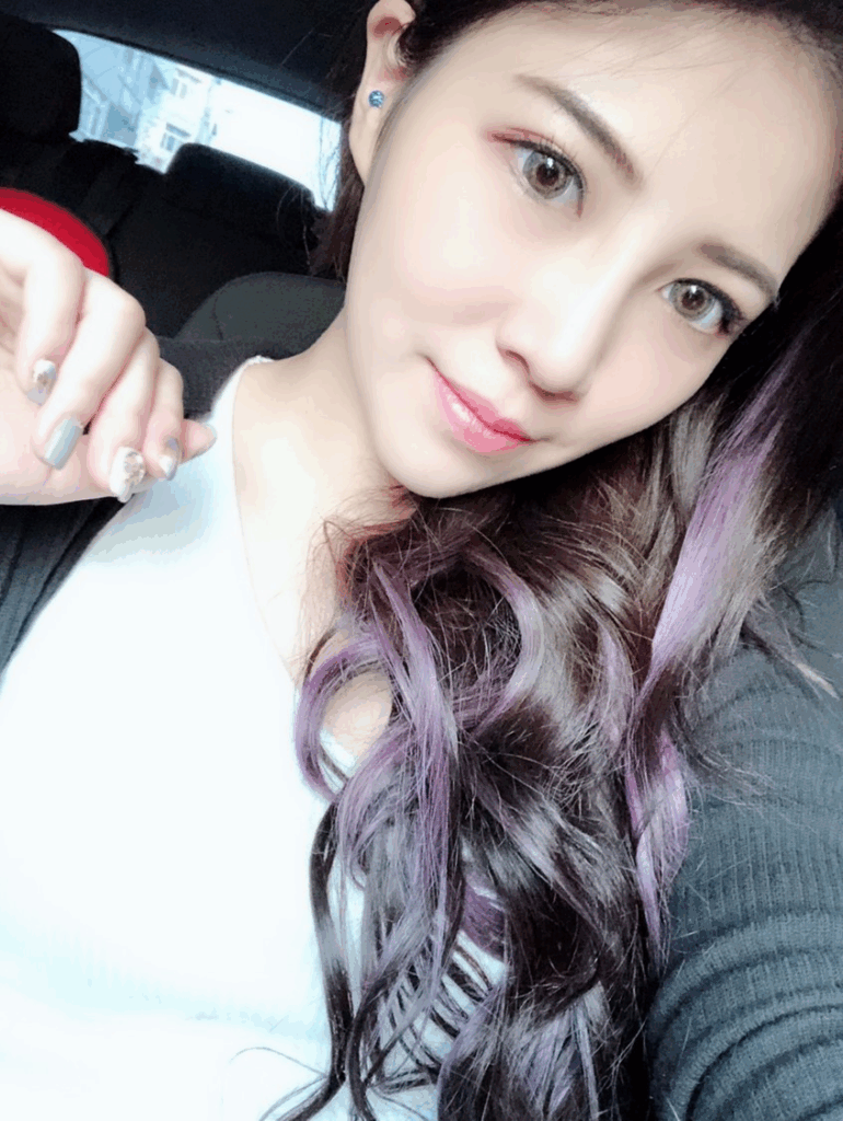 Case1 複合式隆鼻2