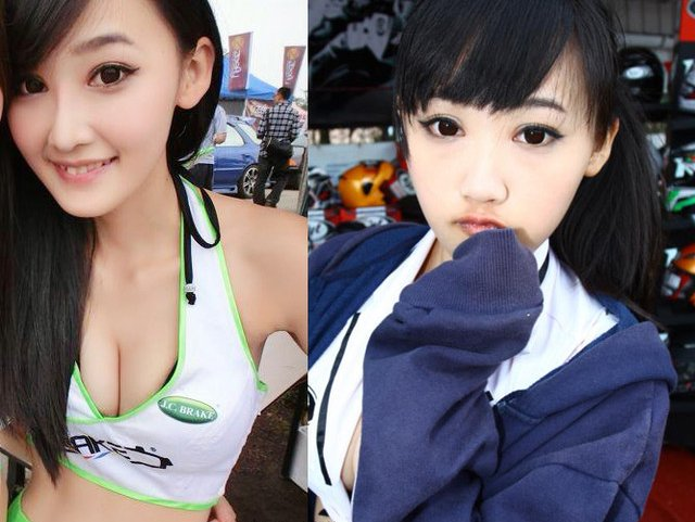 Case4 正統韓式隆鼻 – 韓式隆鼻改造
術前術後照