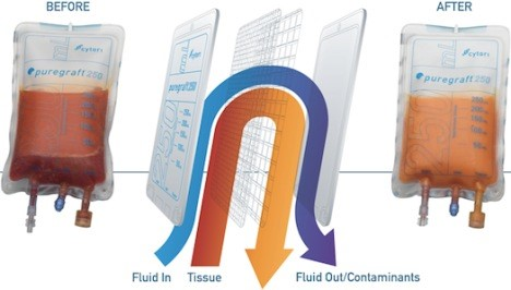 美拉純脂袋：純化脂肪，維持細胞完整性