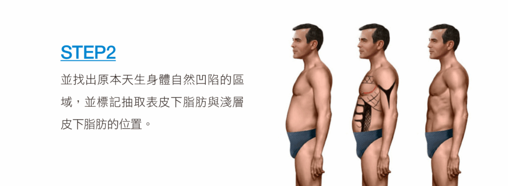 威塑脂雕（VASER）STEP2