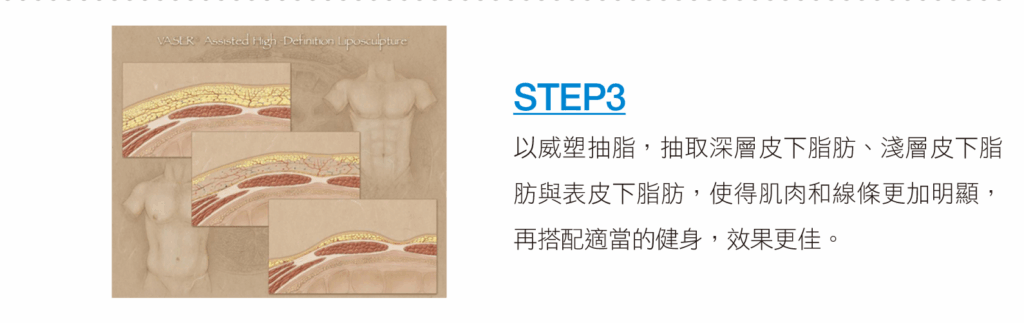 威塑脂雕（VASER）STEP3
