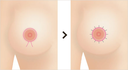 同心圓切口（甜甜圈） vs. 垂直切口（棒棒糖）