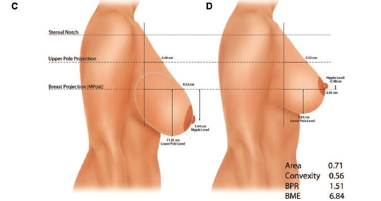側面挺度比較-垂直切口 (I型)