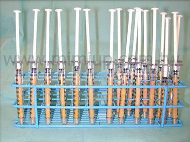 (三) 多層次注射：分裝成多管脂肪，使用精密脂肪槍進行多點、多層次的自體脂肪豐頰。