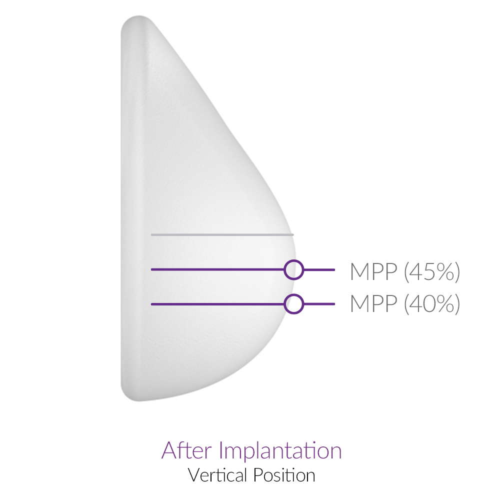 Motiva 魔滴 (波力媚)2