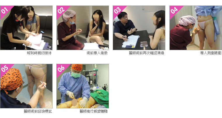 巨星 林敬鈞醫師 自體脂肪隆乳 手術詳細解析