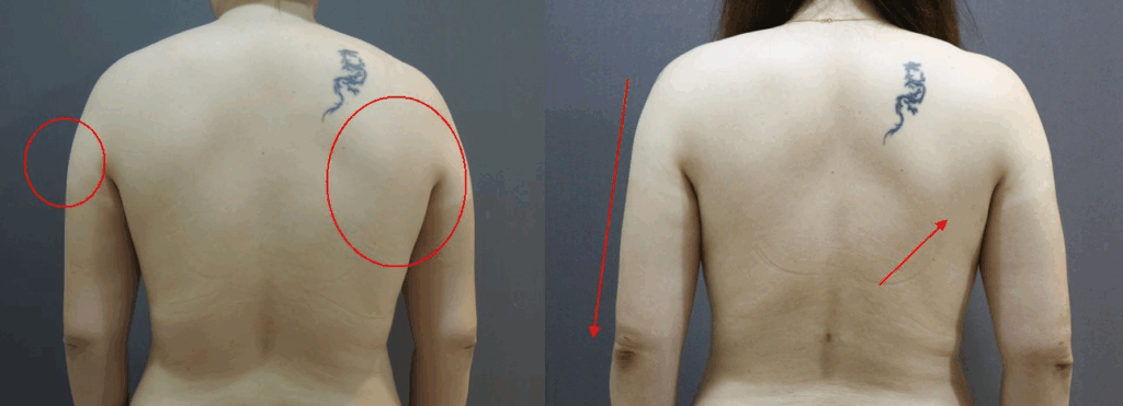 虎背熊腰的感覺明顯改善