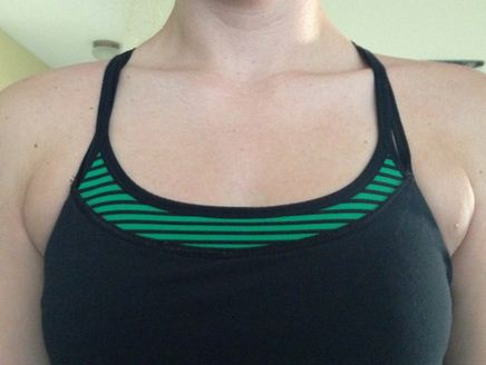 副乳抽脂改善腋下肥肉示意圖