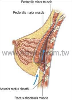 雙面複合式（Dual Plane）技術