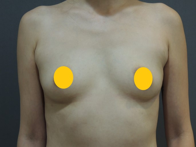 Case 1 術前正面照