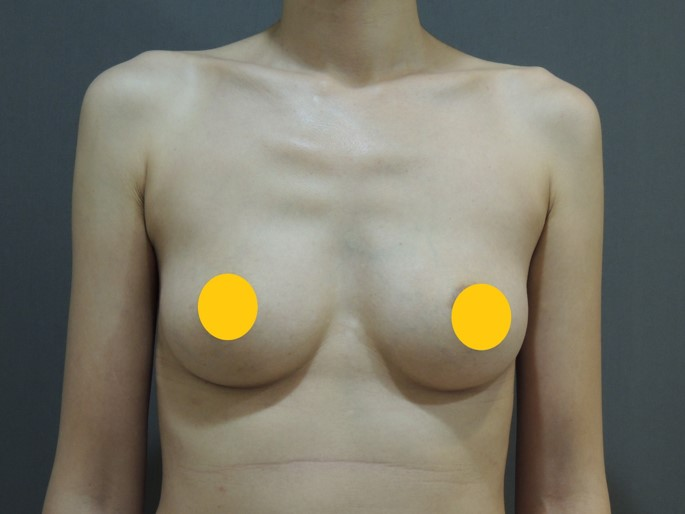 Case 2 術前正面照