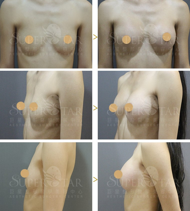 案例四：網紅的火辣性感曲線1