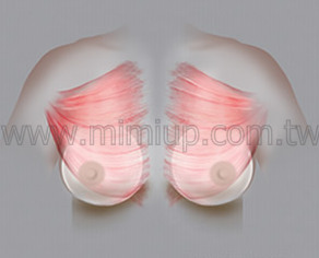 第一型雙面複合式 (Dual Plane I)