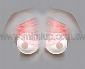 第三型雙面複合式 (Dual Plane III)