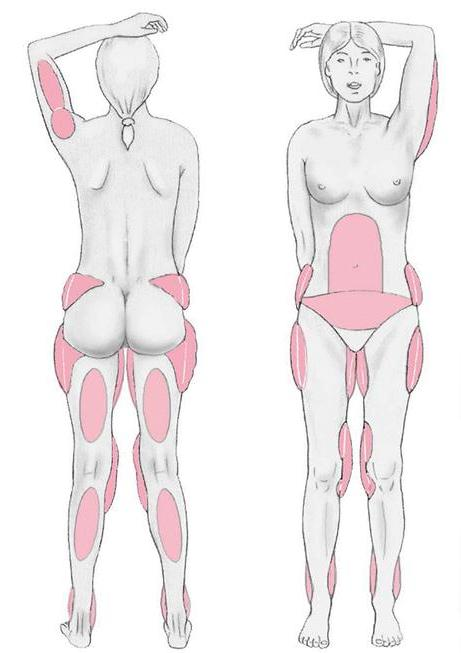 用「體態雕塑」的角度看待抽脂，才能獲得符合期望的滿意度