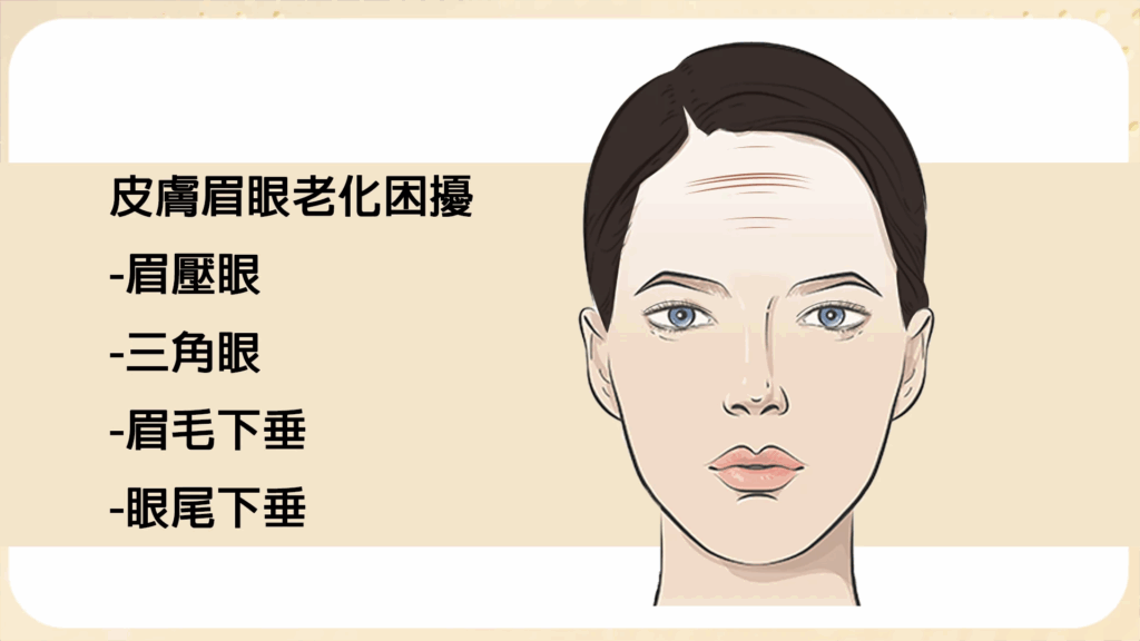 提眉手術比較圖