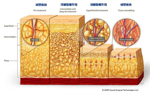 威塑體雕原理大公開