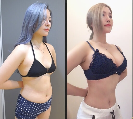 案例分享2右側面