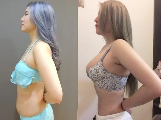 案例分享2左側面