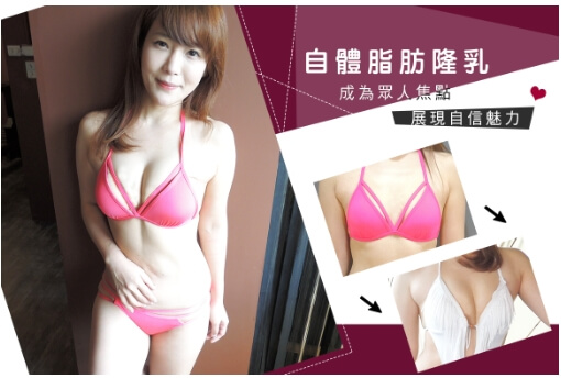 Case 4：威塑自體脂肪隆乳1