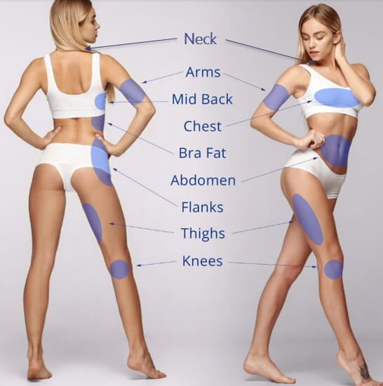 超能電漿 & 複合式電漿抽脂 適合部位