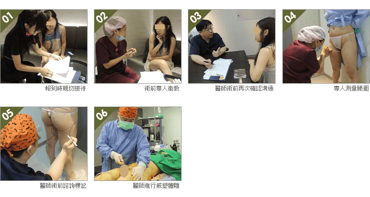 威塑抽脂手術流程