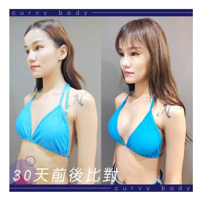 Case 1 30天前後對比