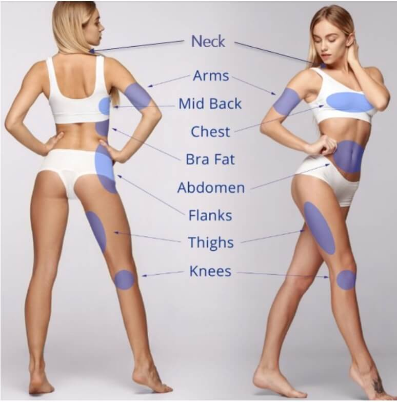 超能電漿（Renuvion）適合治療部位