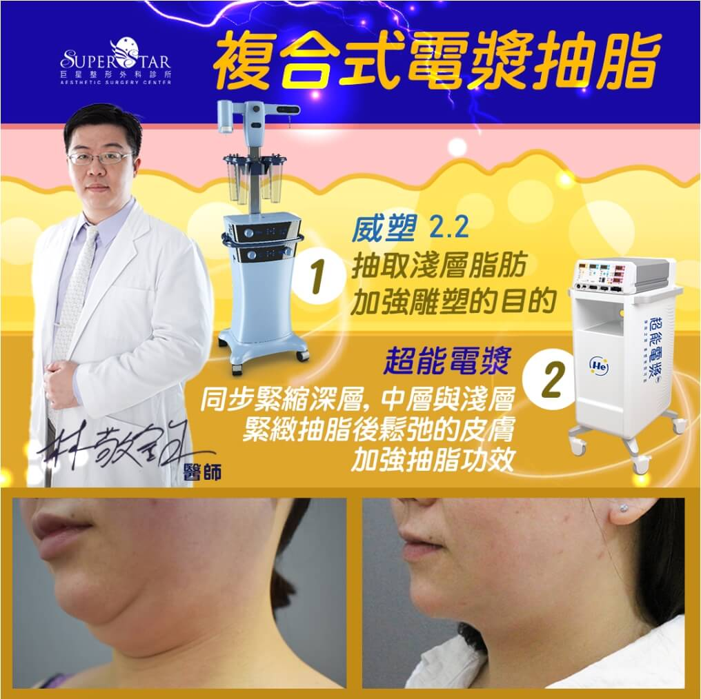 Case 8 複合式電漿抽脂 - 雙下巴抽脂