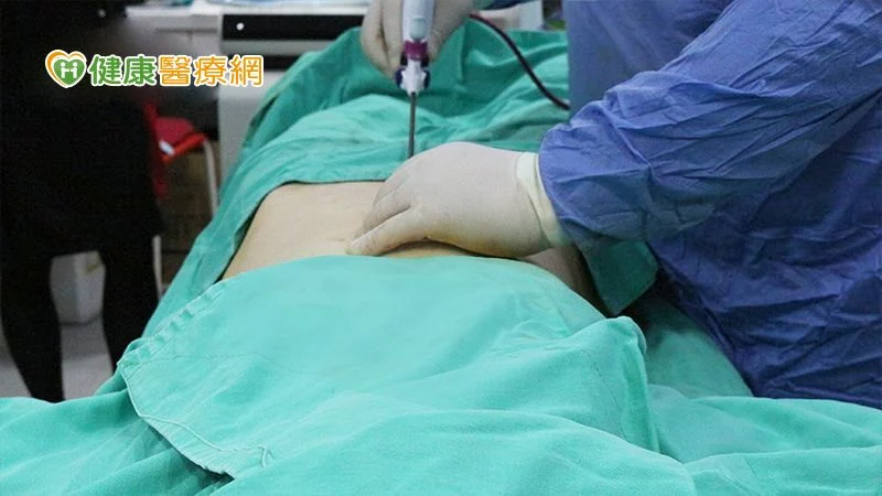 告別肌膚鬆弛 緊實效果超有感