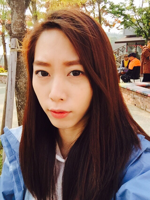 術前臉頰凹陷, 額頭平坦, 眉骨骨感明顯, 太陽穴處凹陷