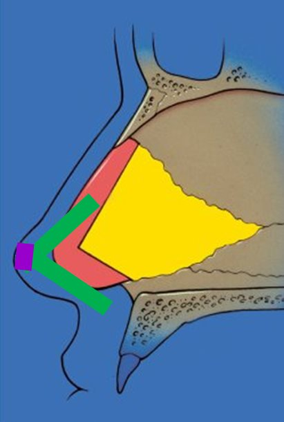海鷗隆鼻技術架構圖