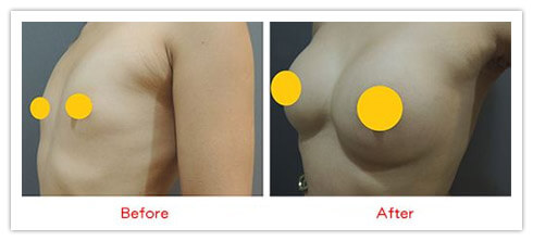 術前術後比對圖