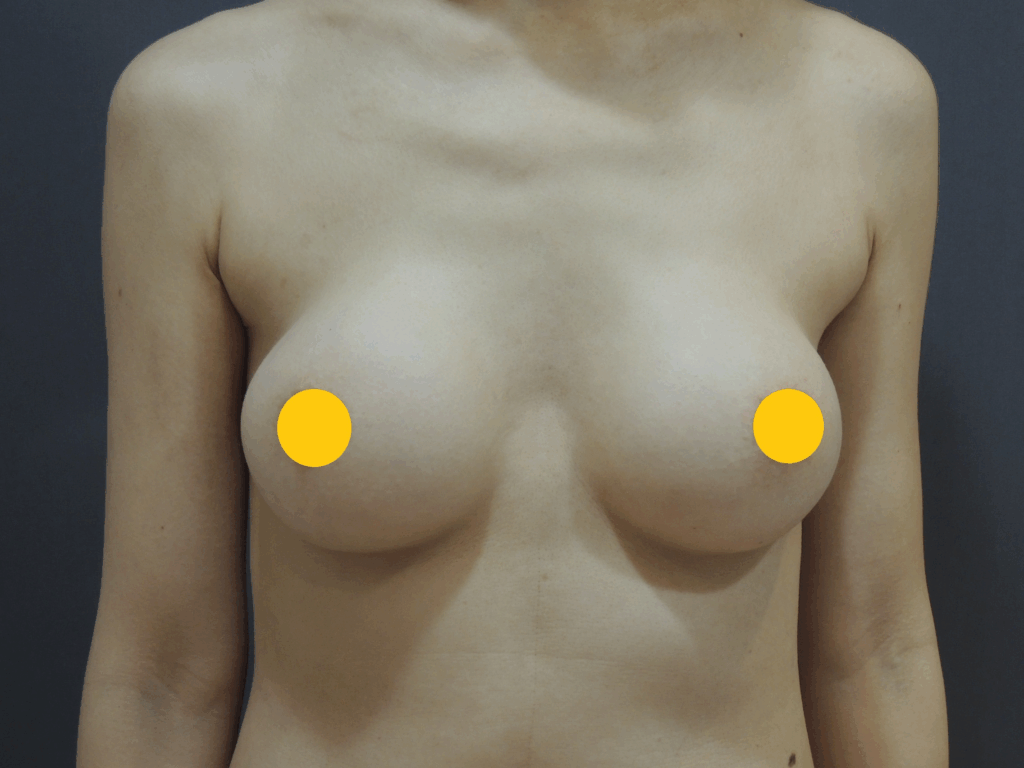 術前 / 術後對比