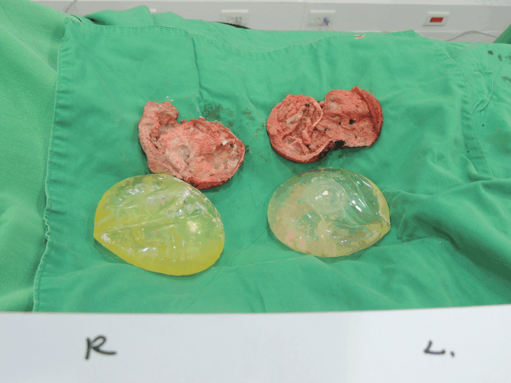 術前 / 術後對比