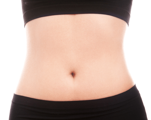 威塑腹部抽脂案例1