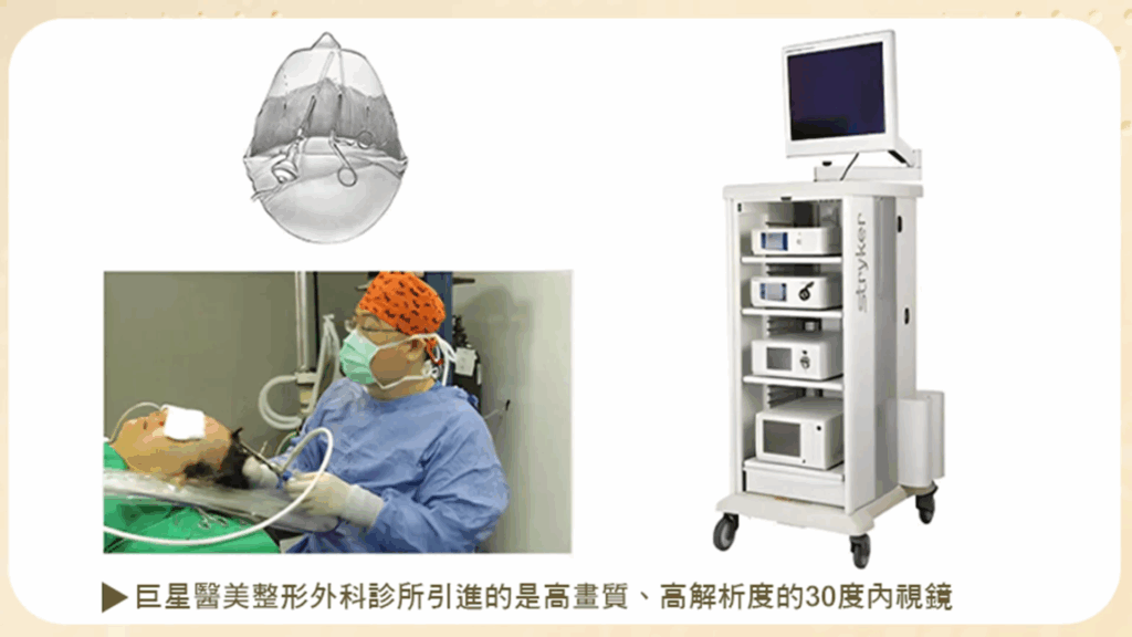 Stryker 內視鏡系統