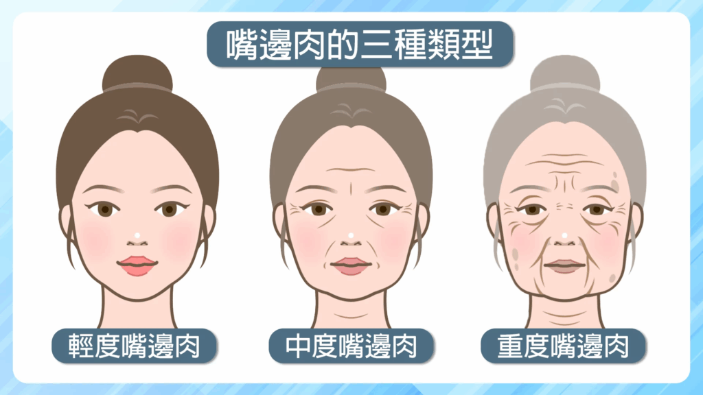 嘴邊肉的三種類型與對策