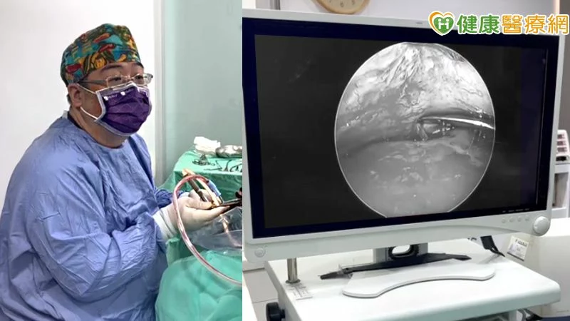 搭配低溫電漿刀與高畫質內視鏡，優化恢復期體驗