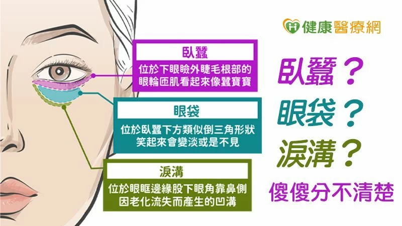 適合全年齡層 一次手術解決眼周與中臉複合困擾