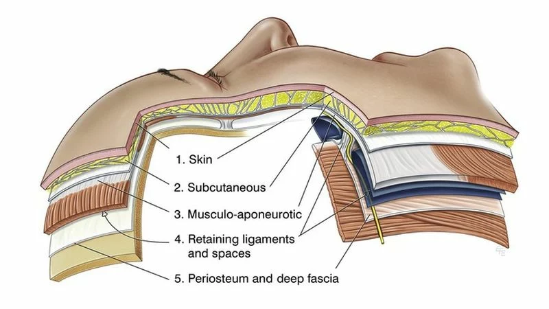 「全層次結構式拉皮」直達臉部「第三區第四層」　拉提輪廓線更緊緻