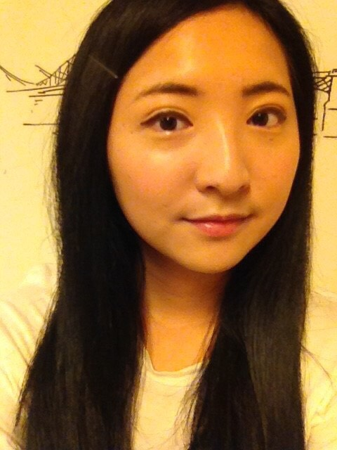 混血萌雙眼皮術後