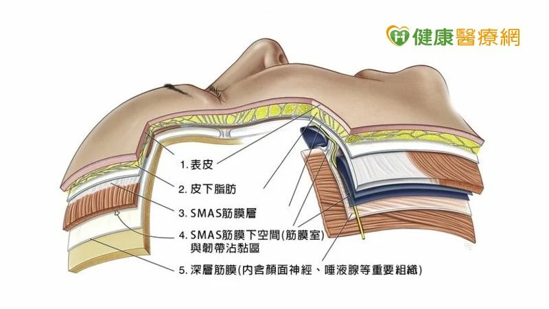 全層次結構式拉皮圖
